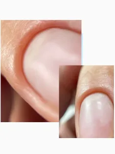 Combi Manicure & &Epsilon;&nu;ί&sigma;&chi;&upsilon;&sigma;&eta; &Phi;&upsilon;&sigma;&iota;&kappa;&omicron;ύ &Nu;&upsilon;&chi;&iota;&omicron;ύ